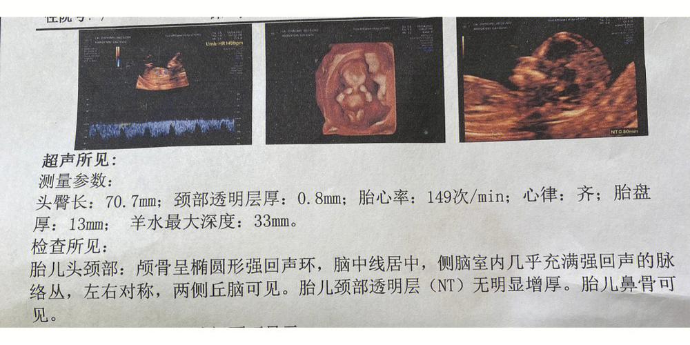 nub点【nub点:解锁身体潜能的关键】