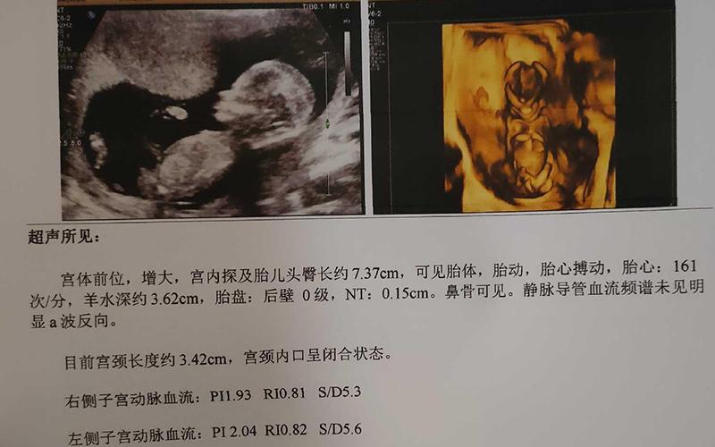 武汉三代供卵试管双胞胎-武汉三代供卵试管双胞胎:科技助力生育的奇迹